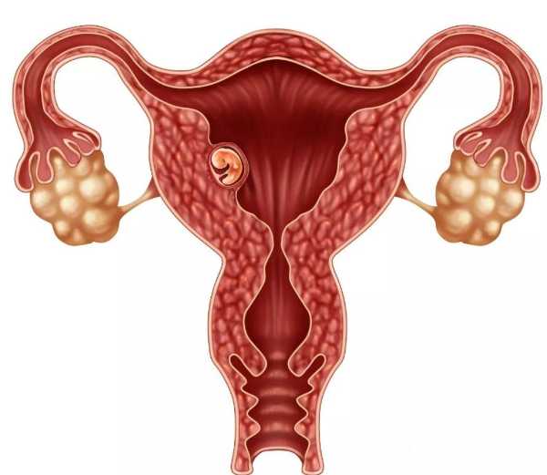 孕期食用泡面会对胎儿造成伤害吗？