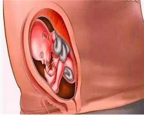 成都亲亲宝贝代孕：孕妇或助孕期间膏药注意谨