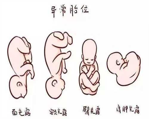 北京代孕产子：景区的安检门对助孕有影响吗