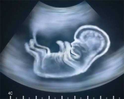 北京试管婴儿代孕价格：孕妇镜检白细胞一个