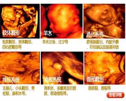 北京哪里有代孕的：第540章代孕了