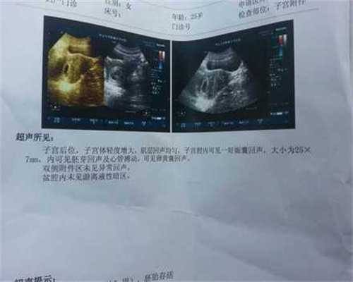 北京供卵试管怎么生双胞胎龙凤胎-代妈代怀电话-北京借卵代生生子到底靠谱吗